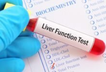 Liver Function Test