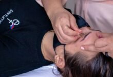 eyebrow treatment search insights